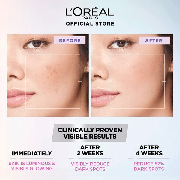 Loreal Paris Glycolic Bright Instant Glowing Face Serum  30ml